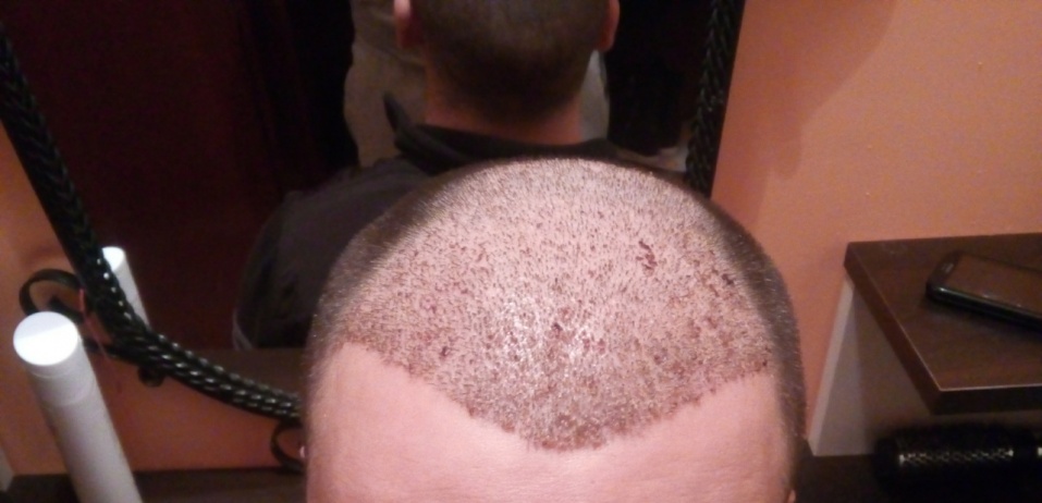 Name:  image-016add923e3dc88dffd75efb317b7d18b438f4e0ab9672c6142233e566c12bf6-V.jpg
Views: 25614
Size:  105.9 KB