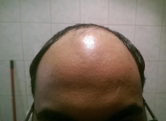 Name:  1A3D8246-206C-4E53-A1D4-B9C6CC7AEE46-2577-0000092BA9CBB995.jpg
Views: 16562
Size:  22.4 KB