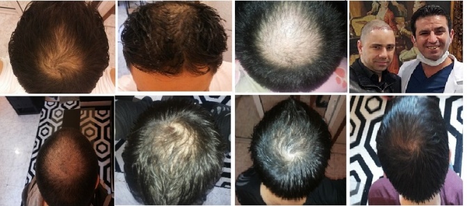 Name:  ���5.jpg
Views: 16544
Size:  98.2 KB